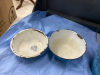 ANTIQUE ENAMEL WARE BLUE PIECES - BUCKET, (2) FLUTED BOWLS, (2) SMALLER BOWLS - 4